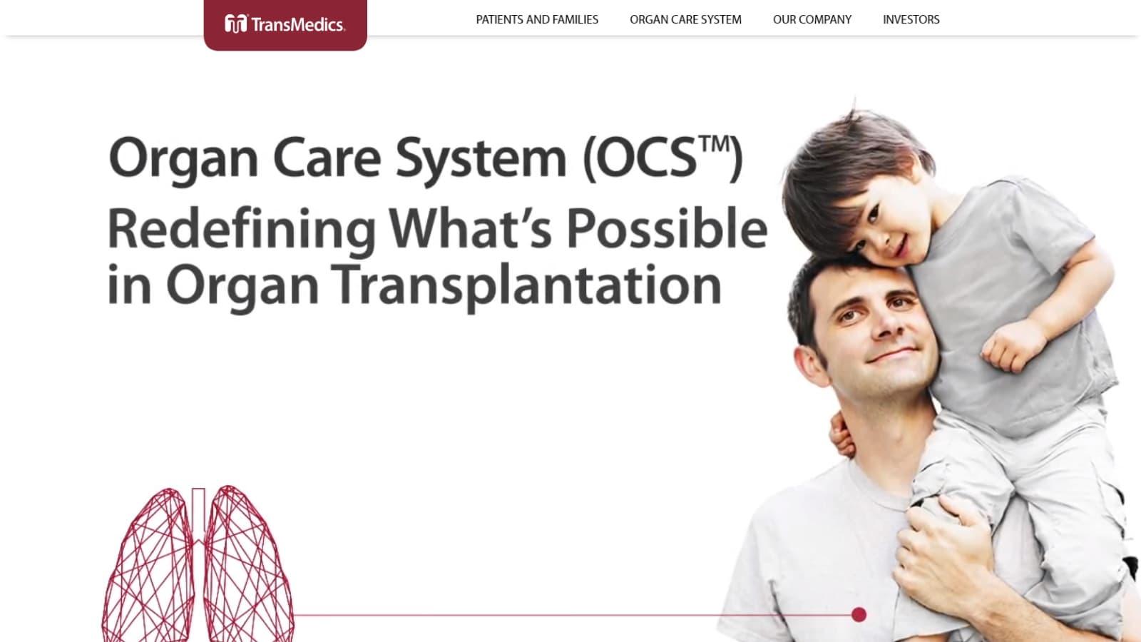 腎臓移植が全米3位の病院、TransMedics製品の導入を評価